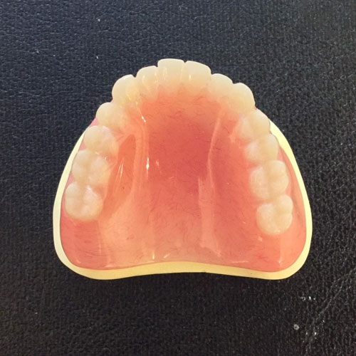 完成 プラスチック入れ歯
